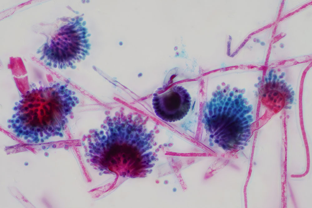 Red mould under the microscope